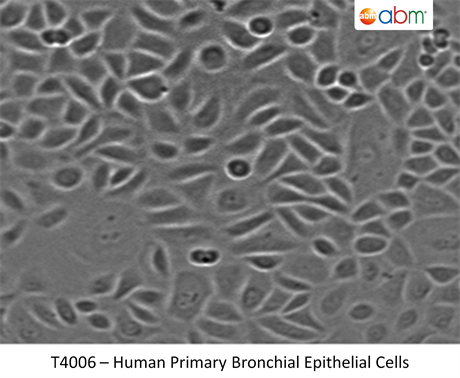 Human Primary Bronchial Epithelial Cells