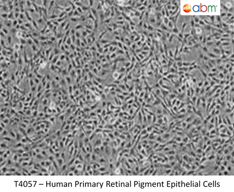 Human Primary Retinal Pigment Epithelial Cells