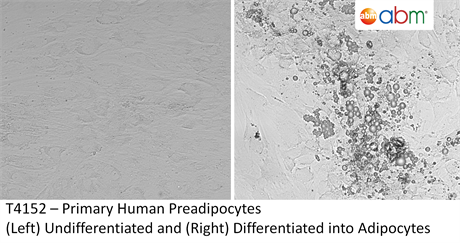 Primary Human Preadipocytes