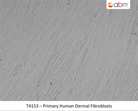 Primary Human Dermal Fibroblasts