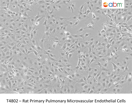 Rat Primary Pulmonary Microvascular Endothelial Cells