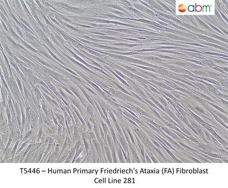 Human Primary Friedriech