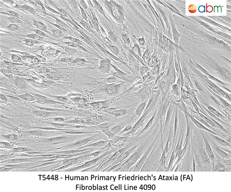 Human Primary Friedriech