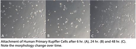 Normal Human Primary Hepatic Kupffer Cells