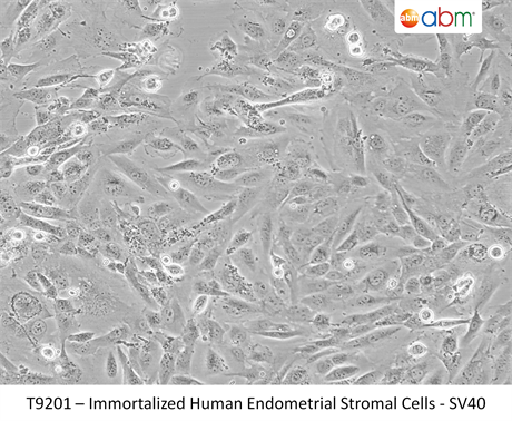 Immortalized Human Endometrial Stromal Cells-SV40