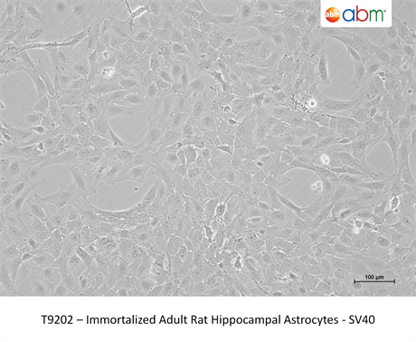Immortalized Adult Rat Hippocampal Astrocytes - SV40
