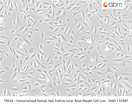 Immortalized Human Hair Follicle Inner Root Sheath Cell Line - SV40 + hTERT P5