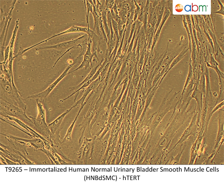 Immortalized Human Normal Urinary Bladder Smooth Muscle Cells (HNBdSMC) - hTERT