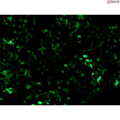 TCF/LEF GFP Reporter Vector