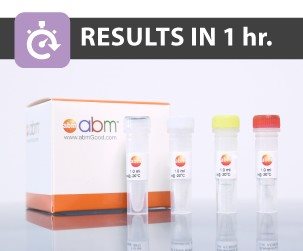 qPCR AAV Titer Kit