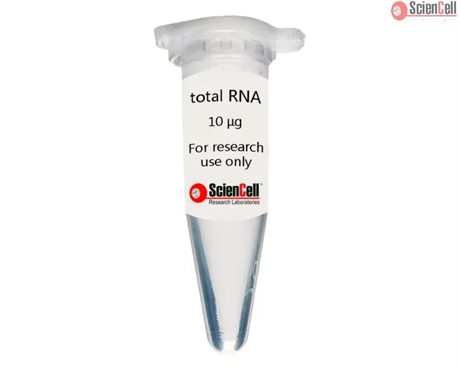 Human Dermal Fibroblast-neonatal Total RNA