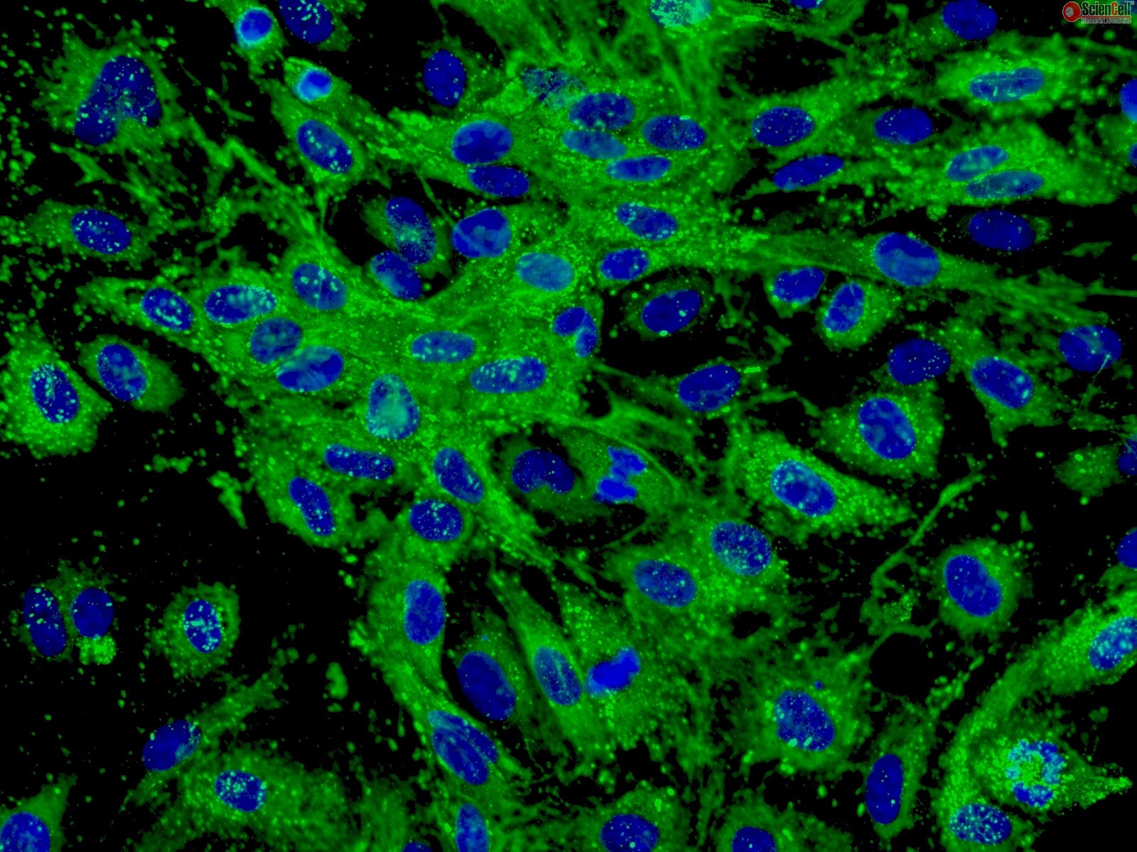Human Dermal Microvascular Endothelial Cells, HDMEC