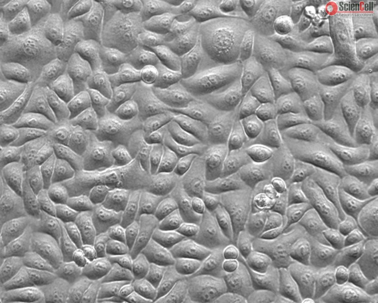 Human Esophageal Epithelial Cells, HEEpiC