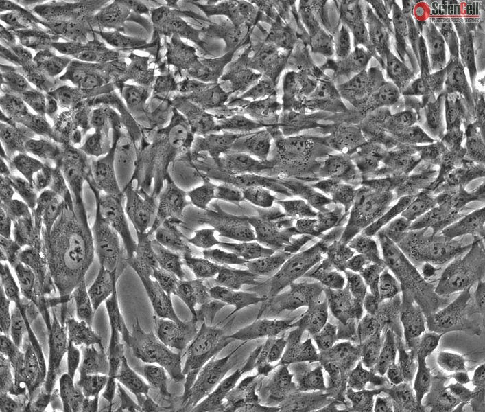 Human Gastric Smooth Muscle Cells