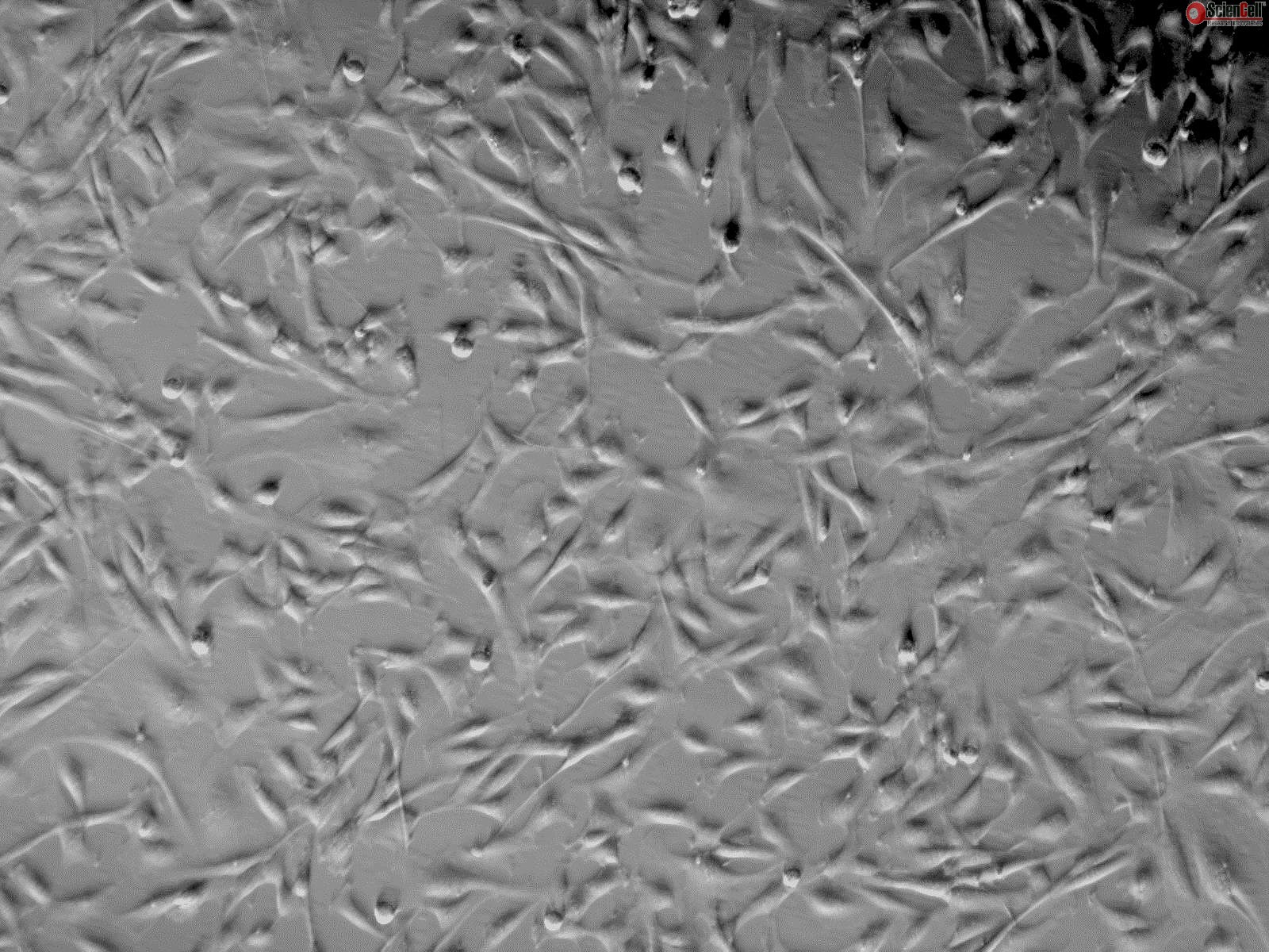 Human Pulmonary Artery Smooth Muscle Cells