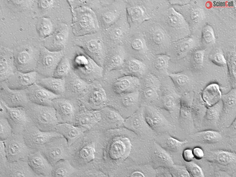 Primary Small Airway Epithelial Cells; Normal, Human – OVFRQ