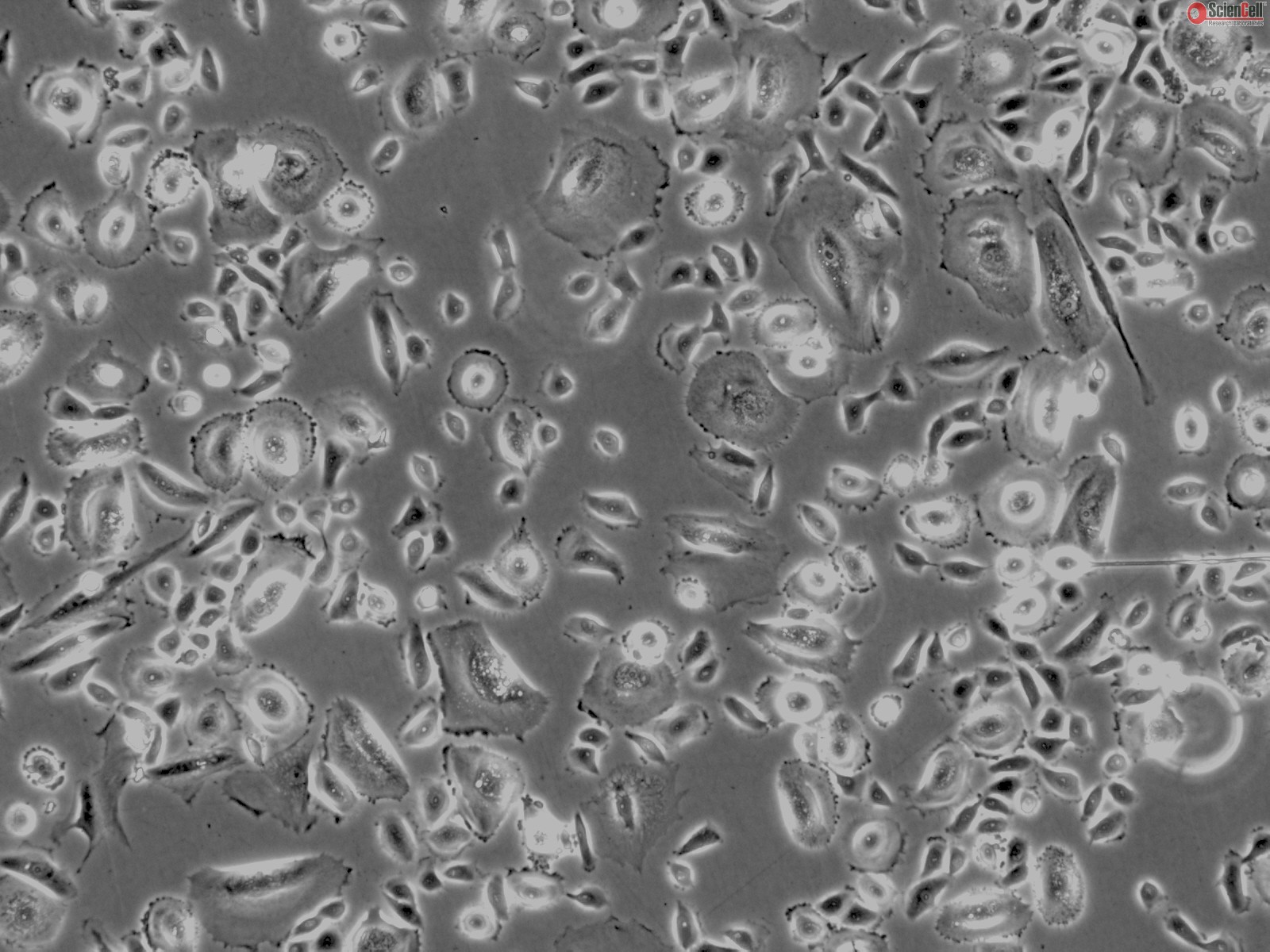 Human Thymic Epithelial Cells (HTyEpiC)