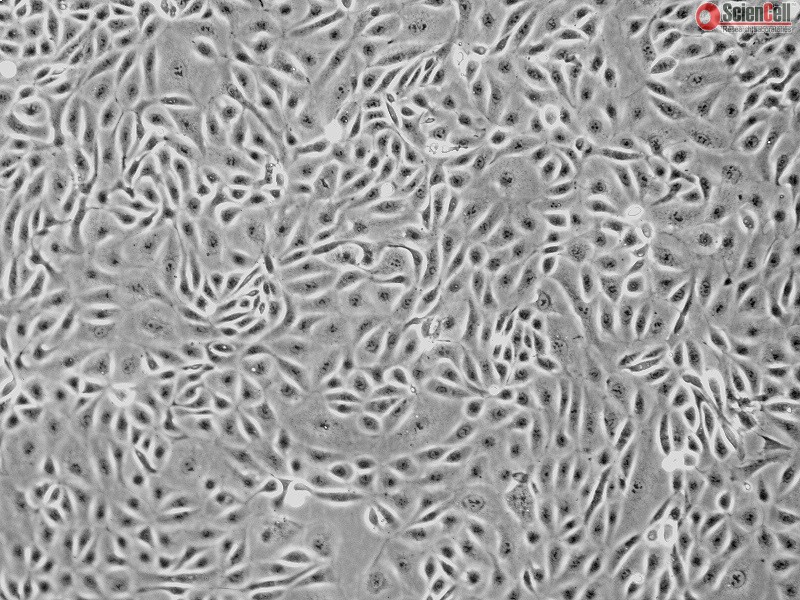 Human Renal Proximal Tubular Epithelial Cells, Passage 1, HRPTEpiC
