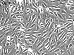 Human Renal Proximal Tubular Epithelial Cells, Passage 1, HRPTEpiC
