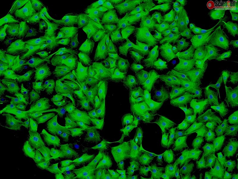 Human Seminal Vesicle Epithelial Cells