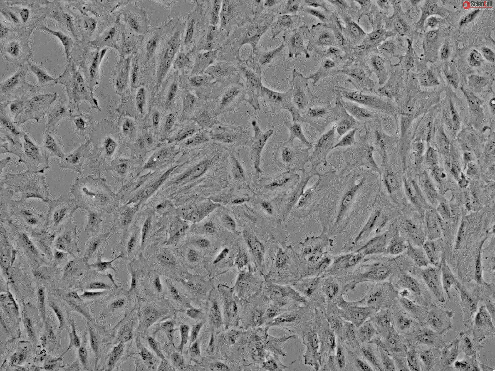 Human Lens Epithelial Cellsadult, Passage 1