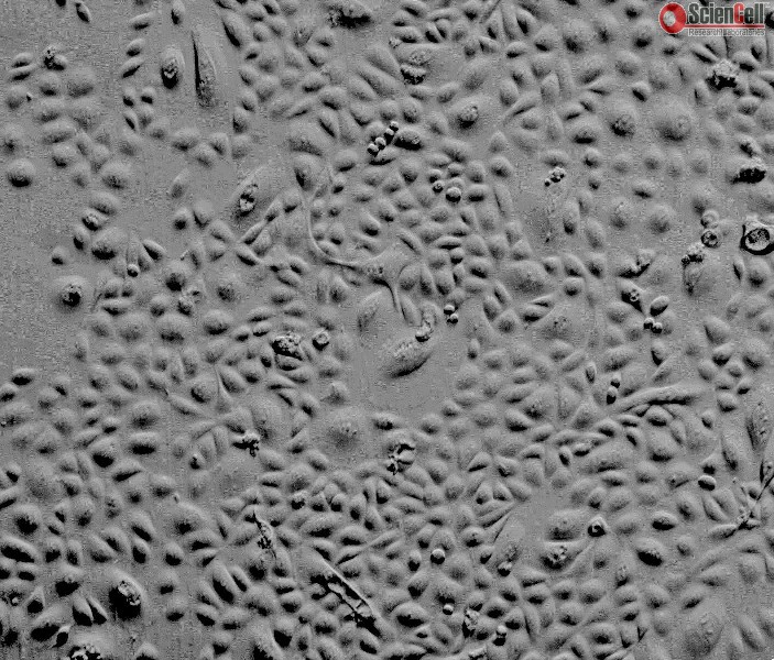 Human Ovarian Surface Epithelial Cells