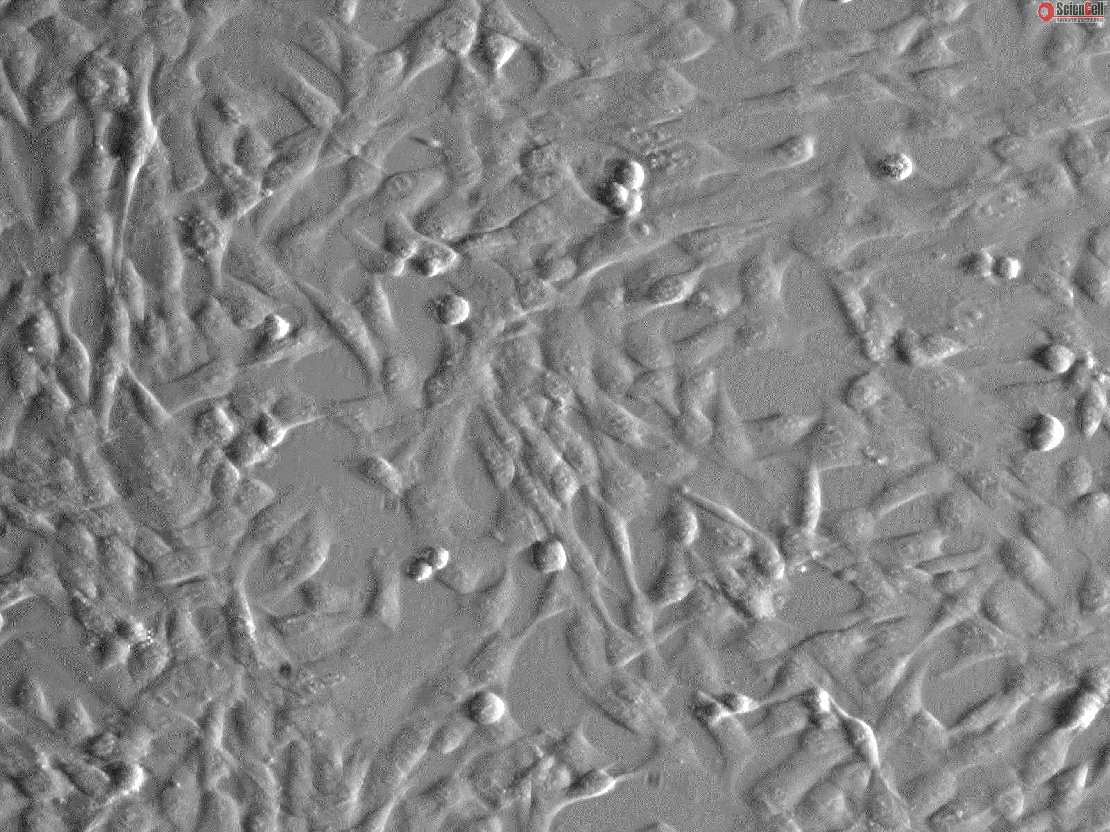 Humsc Cell Human Umbilical Mesenchymal Stem Cells, HUMSC