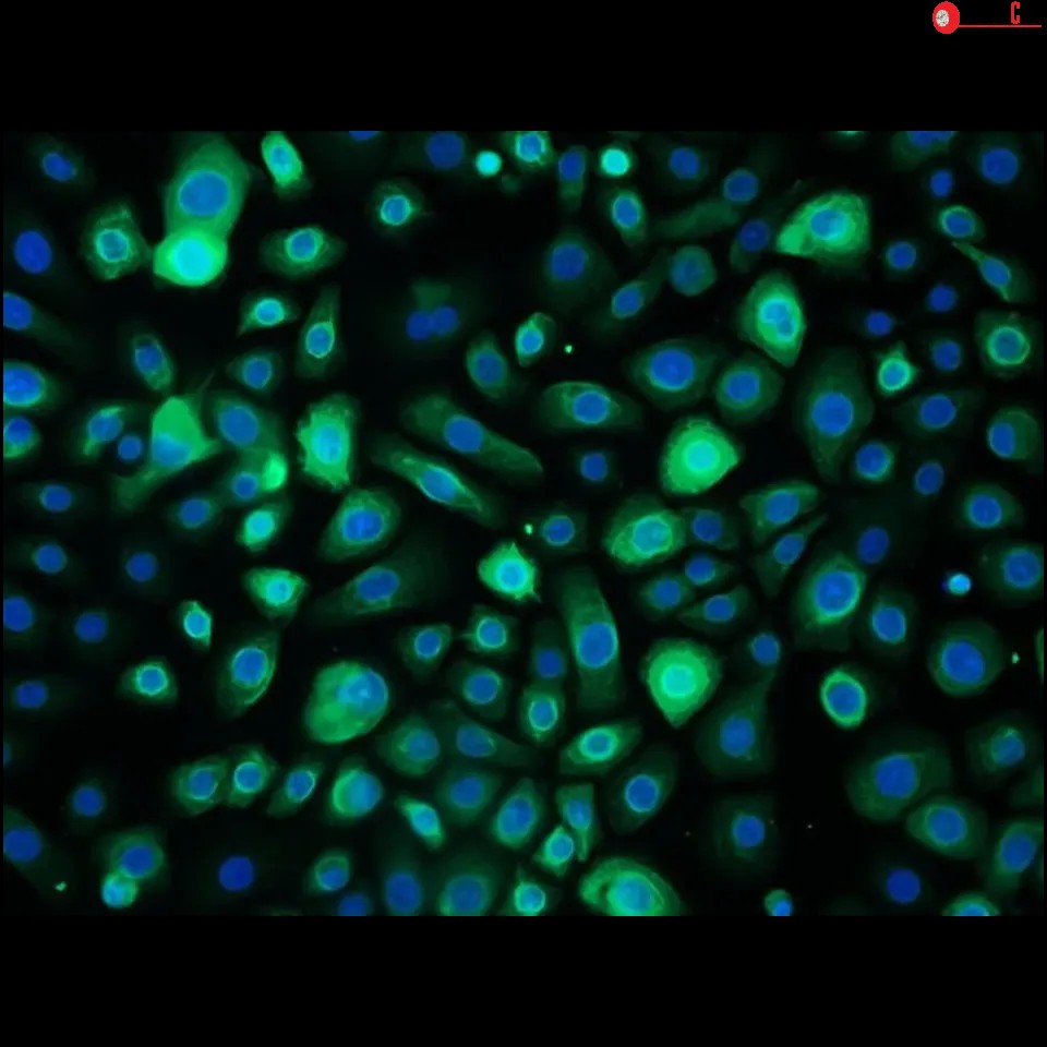 Human Bronchial Epithelial Cells - adult
