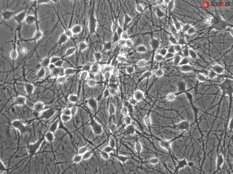 Introduction to Cortical Neurons