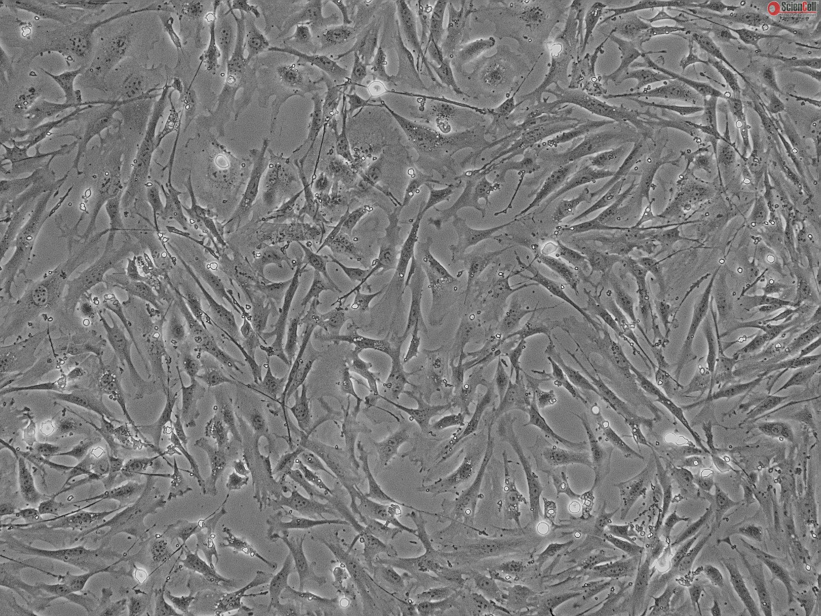 Mice cells. Мезенхимальные стволовые клетки под микроскопом. Мезенхимальные стромальные клетки. Стволовые клетки микрофотография. Мезенхимальные стволовые клетки костного мозга.