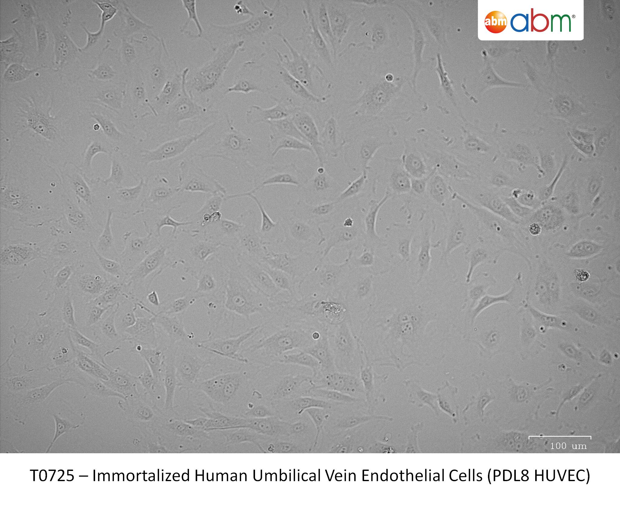 Immortalized Human Umbilical Vein Endothelial Cells (PDL8 HUVEC)