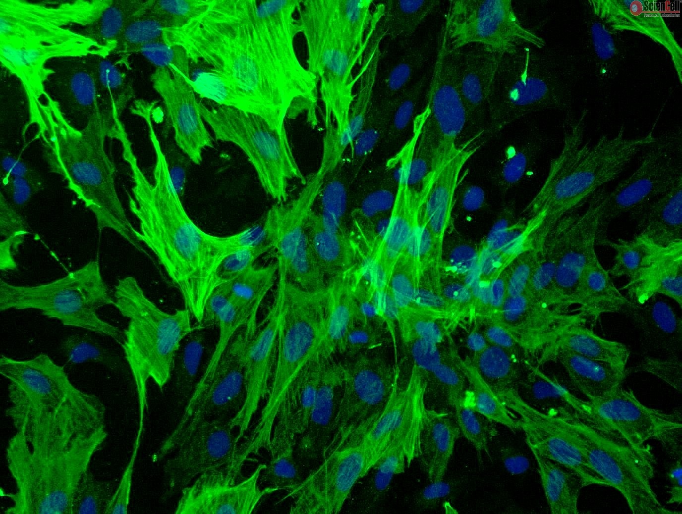 Rabbit Renal Mesangial Cells