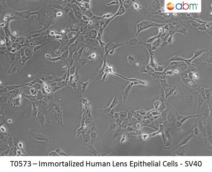 Immortalized Human Lens Epithelial Cells - SV40