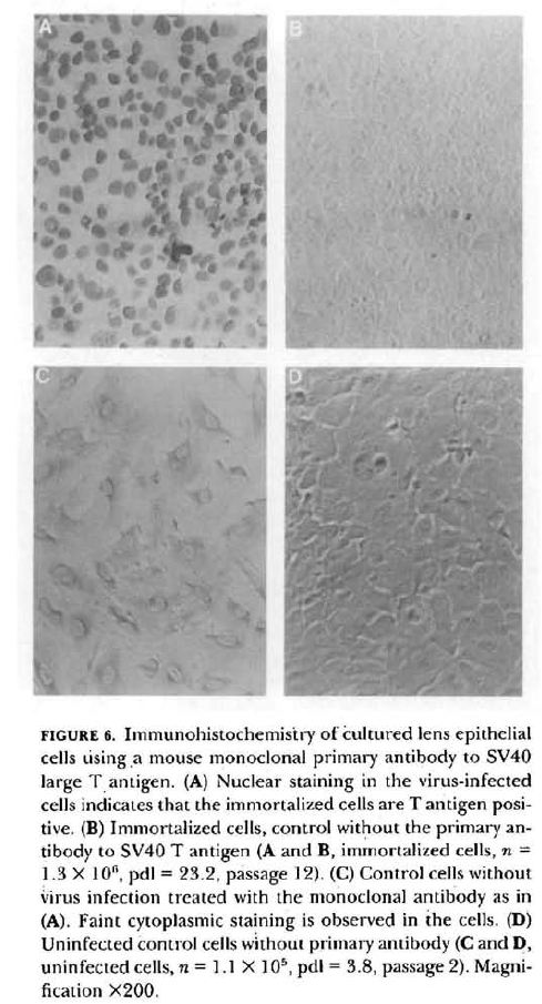 Immortalized Human Lens Epithelial Cells - SV40
