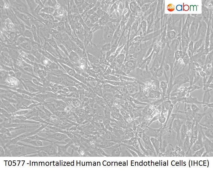 Immortalized Human Corneal Endothelial Cells (IHCE)