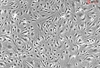 Human Choroid Plexus Endothelial Cells, Passage 1