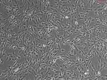 Human Leptomeningeal Pericytes, Passage 1