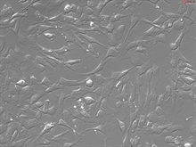 Human Leptomeningeal Pericytes, Passage 1