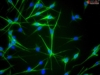 Human Epidermal Melanocytes-medium, HEM-m, Passage 1