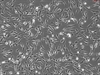 Human Scalp Fibroblasts-fetal