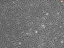 Human Tonsil Endothelial Cells, Passage 1, HTEC