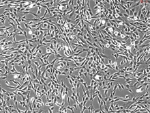 Human Oral Fibroblasts