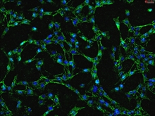 Human Gastric Fibroblasts