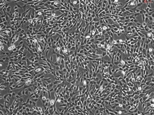 Human Gastric Fibroblasts