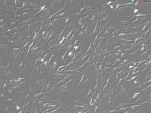 Human Gastric Fibroblasts