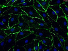 Human Rectal Microvascular Endothelial Cells, Passage 1