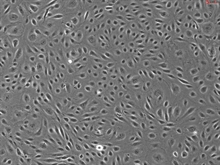 Human Rectal Microvascular Endothelial Cells, Passage 1