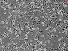 Human Bronchial Fibroblasts