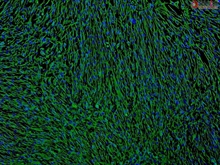 Human Bronchial Fibroblasts