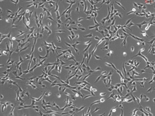 Human Tracheal Fibroblasts